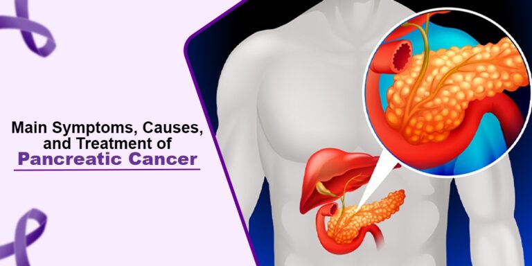 Main Symptoms Causes And Treatment Of Pancreatic Cancer