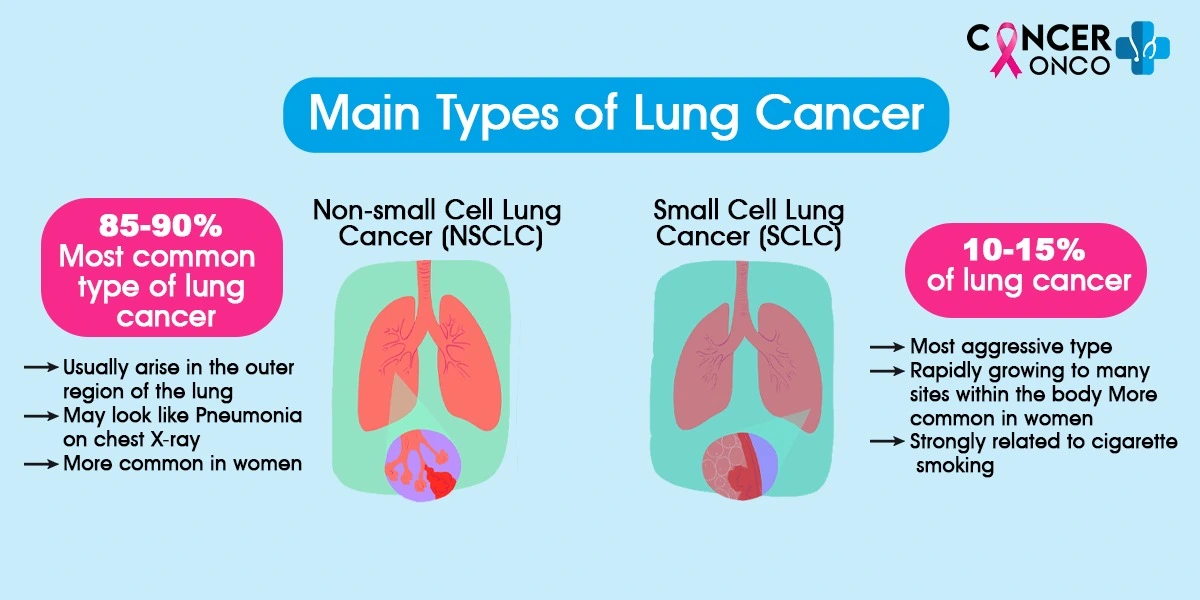 Main Types of Lung Cancer