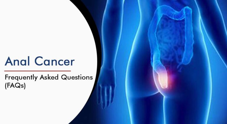 Read more about the article Anal Cancer: Frequently Asked Questions (FAQs)
