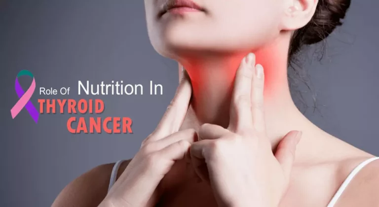 Read more about the article Role Of Nutrition In Thyroid Cancer