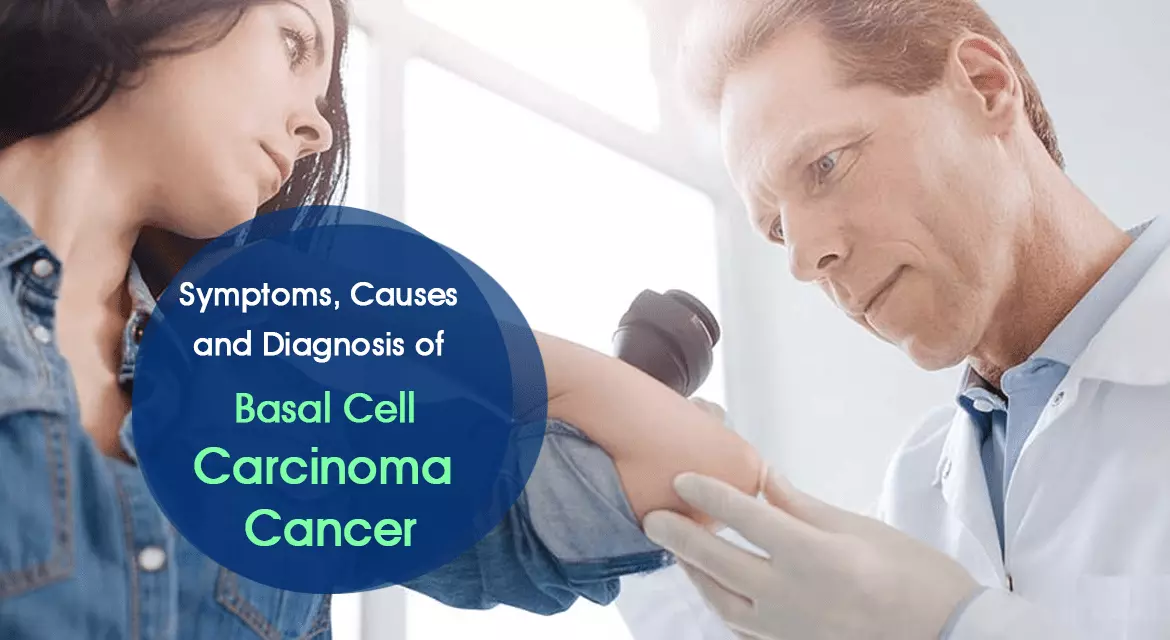 Read more about the article Basal Cell Carcinoma Cancer Symptoms, Causes, and Diagnosis Treatment