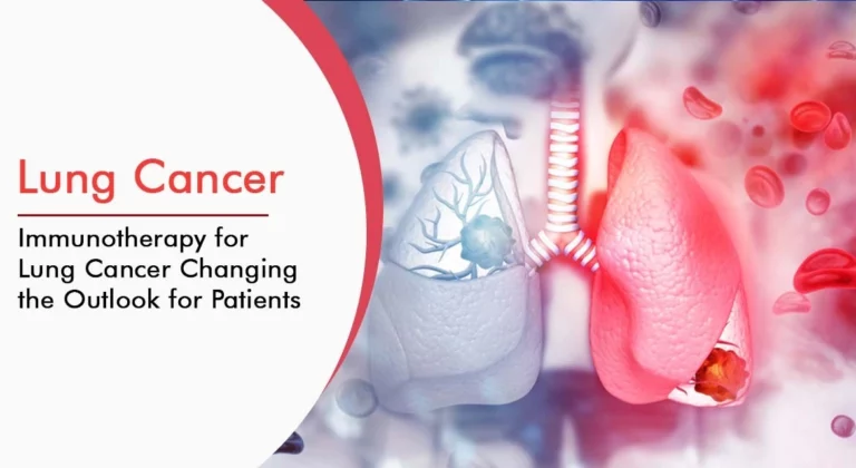 Read more about the article Lung Cancer, Immunotherapy for Lung Cancer Changing the Outlook for Patients
