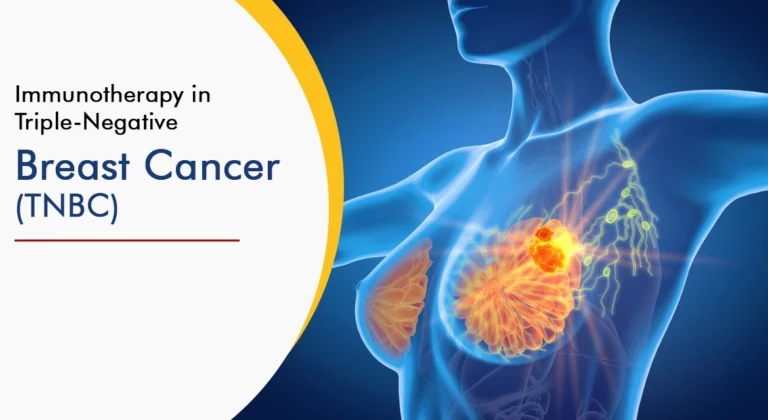 Read more about the article Immunotherapy in Triple Negative Breast Cancer (TNBC)