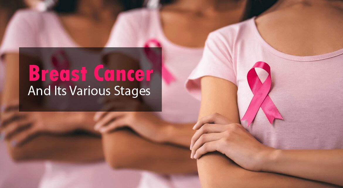You are currently viewing About Breast Cancer, Its Various Stages and Symptoms