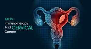Read more about the article FAQs: Immunotherapy and Cervical Cancer
