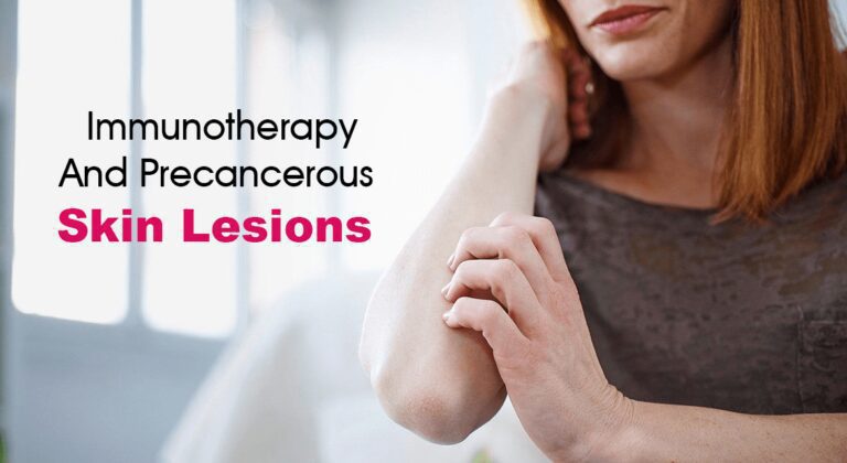 Immunotherapy And Precancerous Skin Lesions - canceronco