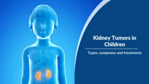 Read more about the article Kidney Tumors in Children, types, symptoms and treatments