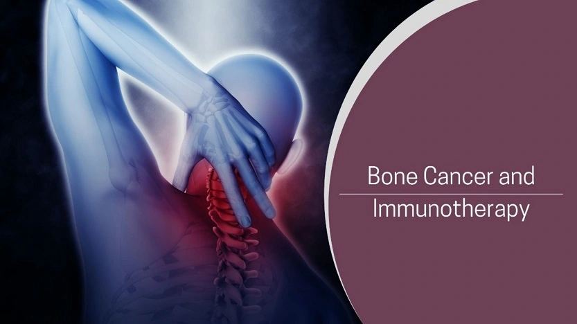 Bone Cancer and Immunotherapy