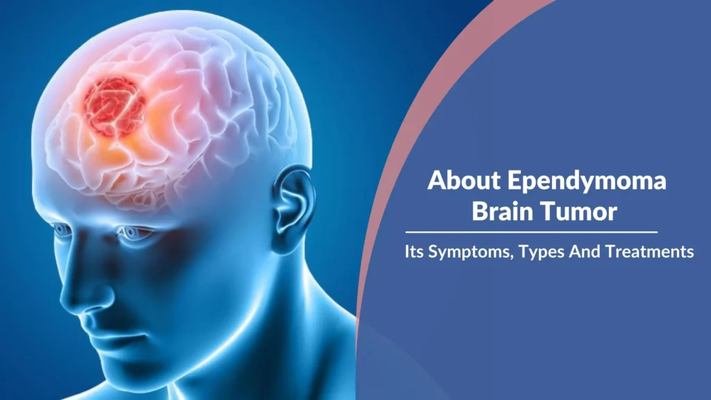 About Ependymoma Brain Tumor, Its Symptoms, Types And Treatments