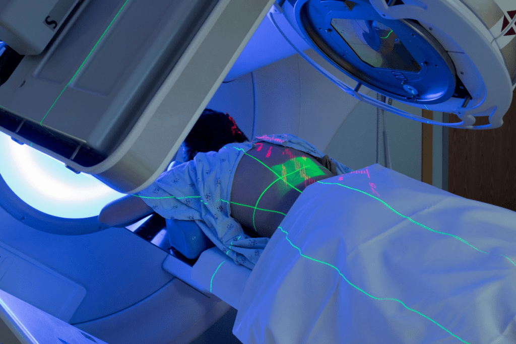 What is Radiation Therapy? And can it cure Cancer?