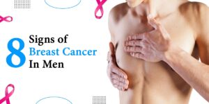 Read more about the article 8 Signs of Breast Cancer In Men