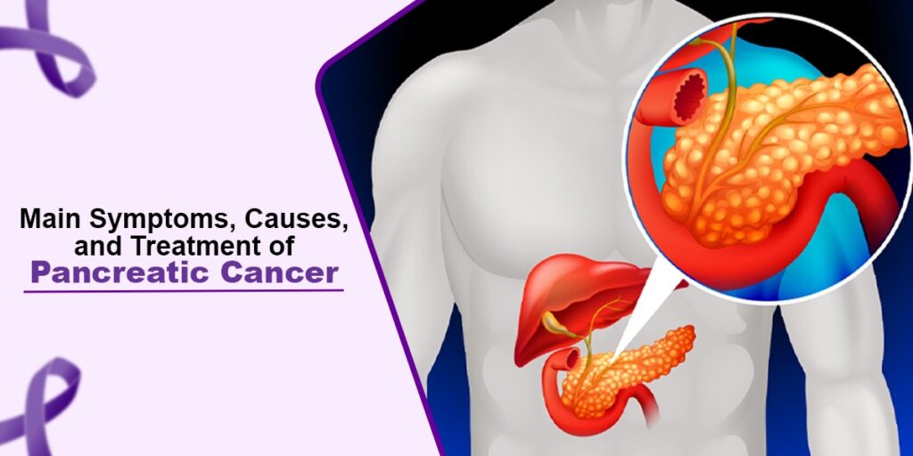 Main Symptoms Causes And Treatment Of Pancreatic Cancer 7461