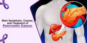Read more about the article Main Symptoms, Causes, and Treatment of Pancreatic Cancer