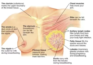 What Is Breast Cancer Stage 4?