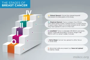 Treatments for breast cancer stage