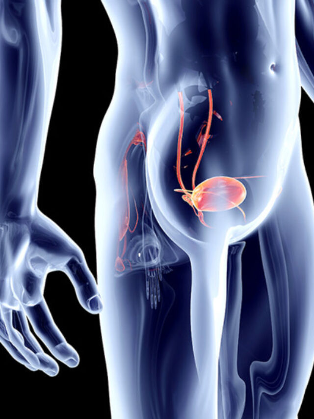 Read more about the article Bladder Cancer in Delhi NCR