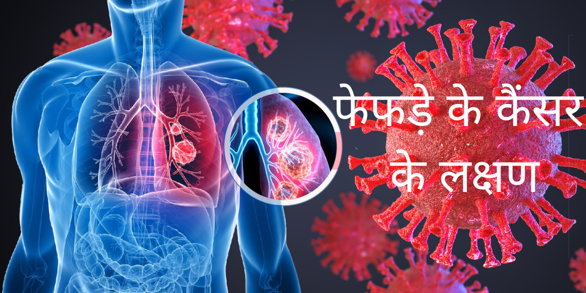 Read more about the article फेफड़े के कैंसर के 10 लक्षण | Lung cancer in Hindi