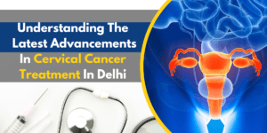 Read more about the article Understanding the Latest Advancements in Cervical Cancer Treatment in Delhi
