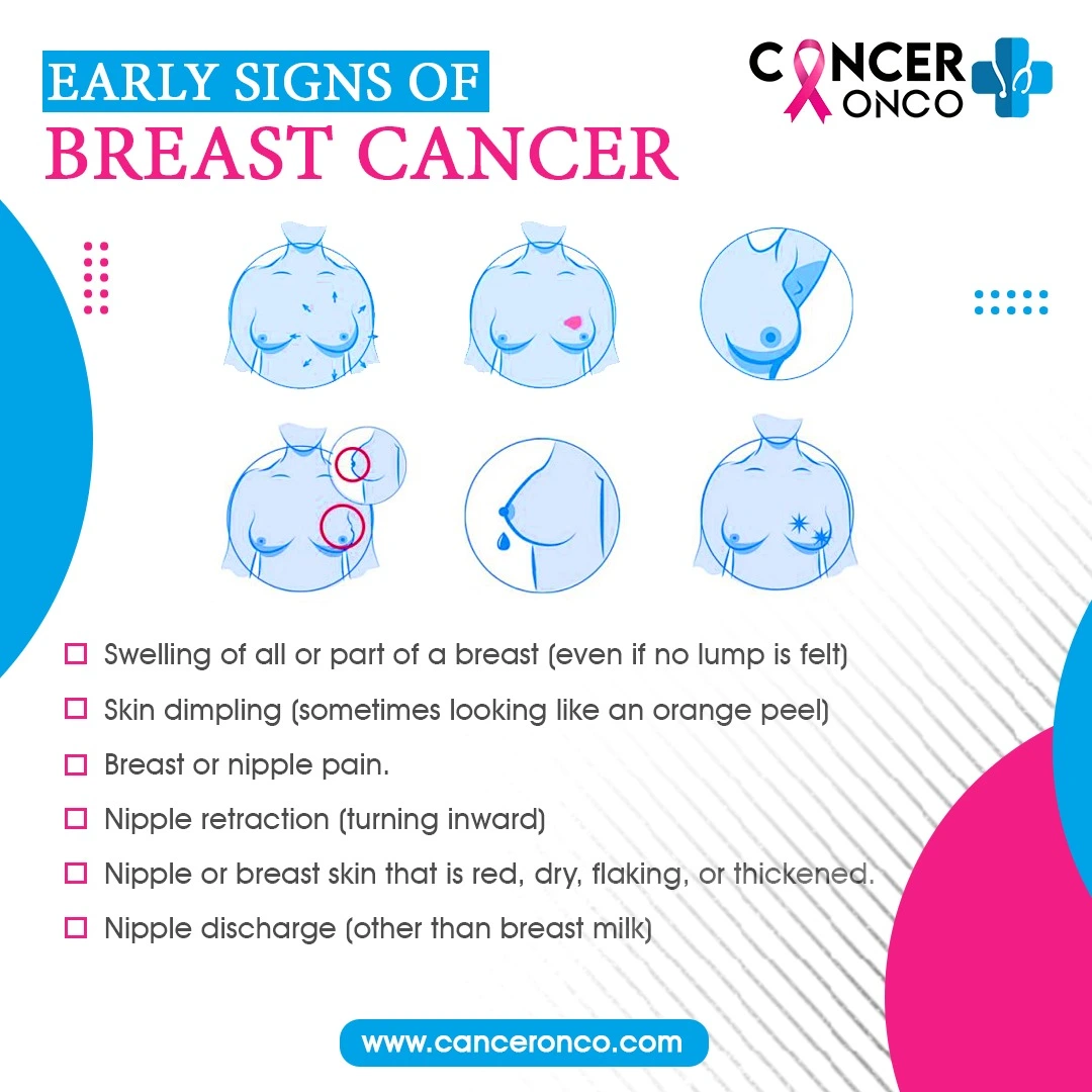 Early Sign of Breast Cancer