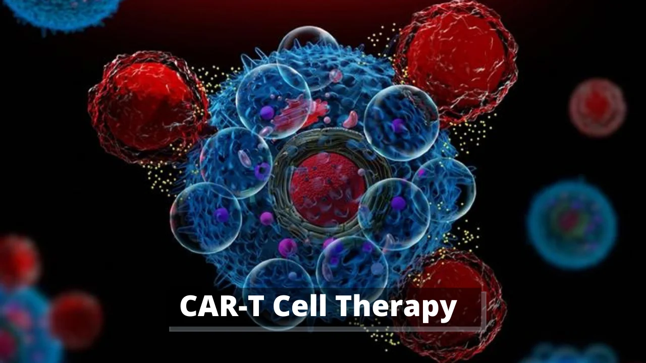 CAR-T Cell Therapy 