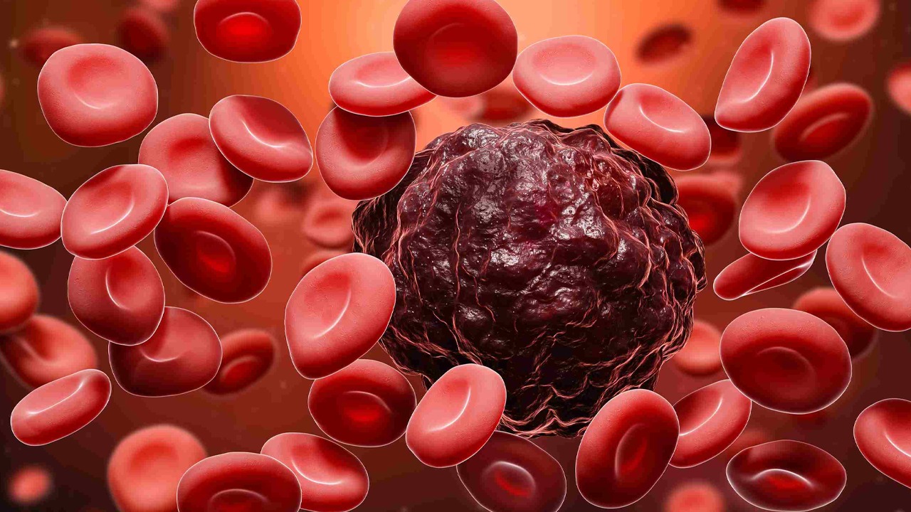 Blood Cancer Specialist Doctor in Delhi