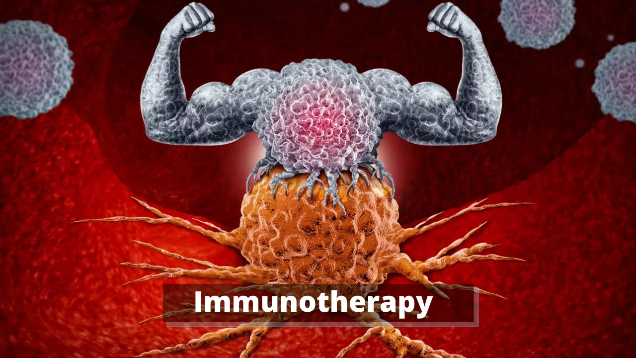 Immunotherapy 
